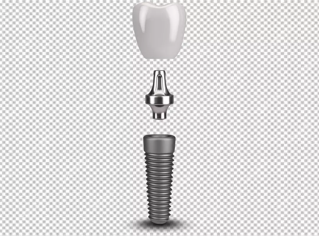 Disassembled Dental Implant System Showing Crown, Abutment, and Screw on Black