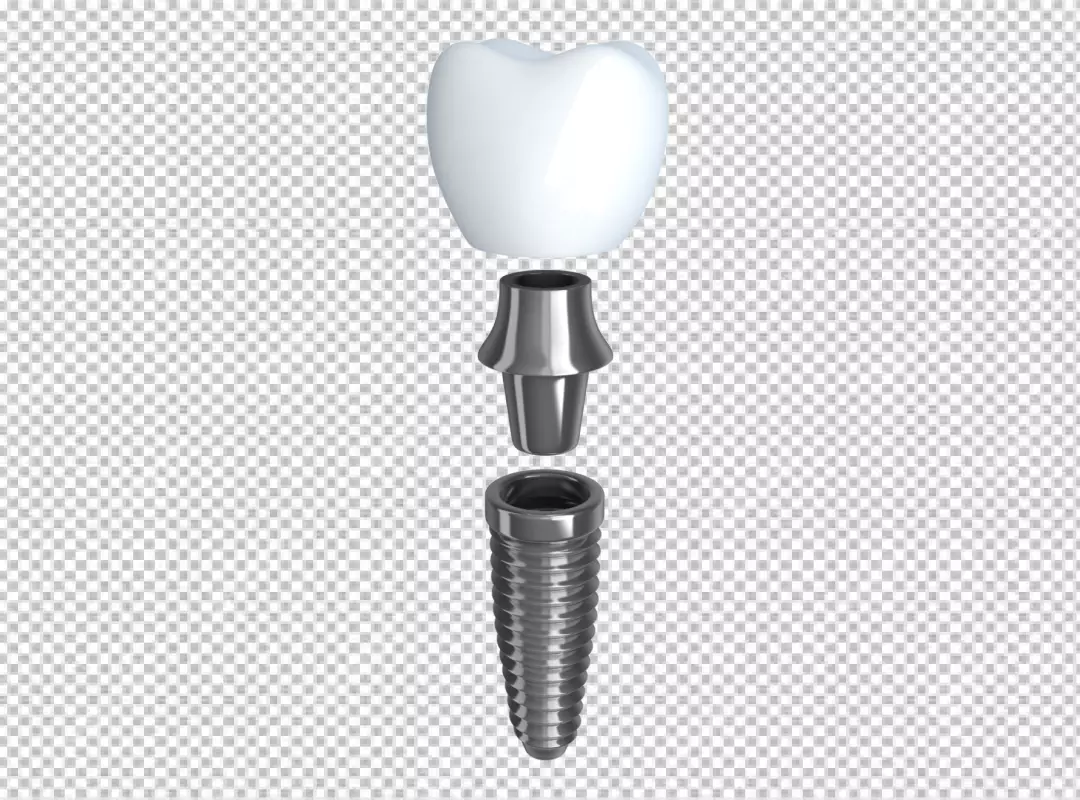 Three-Part Dental Implant System Components Disassembled for Clear Medical Education
