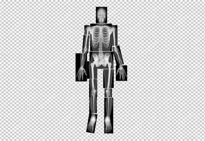 Segmented Human Skeleton X-ray or Modular Human Bone Radiograph