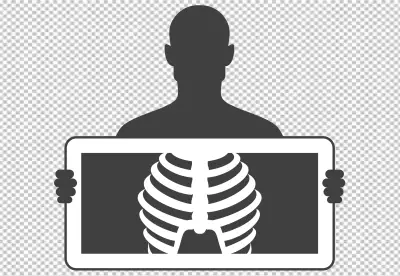 X-ray of a Human chest
