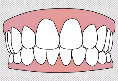 a set of teeth in a healthy state