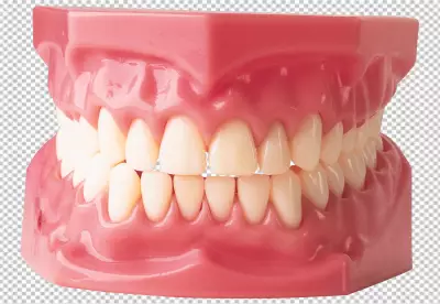 A set of upper human teeth in a pink gum