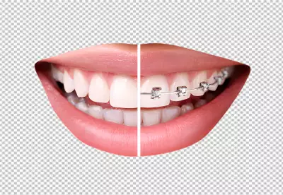 a woman's teeth before and after braces