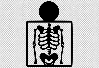 X-ray of the Human Thorax