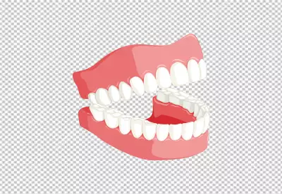 A set of dentures prosthesis that replaces missing teeth