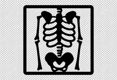 Skeleton X-ray or Human Skeleton Radiograph