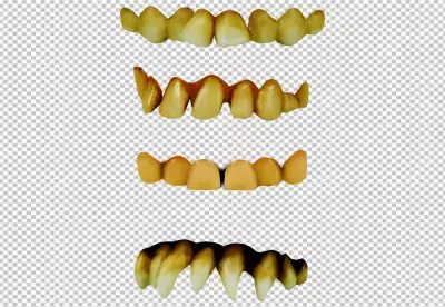 a set of four rows of teeth