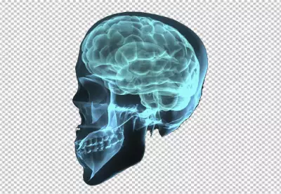 X-ray of a Human Head