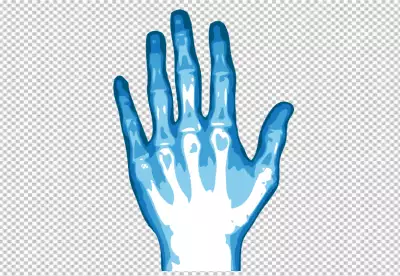 Blue-Tinted Hand X-ray or Hand Radiograph with Blue Hue