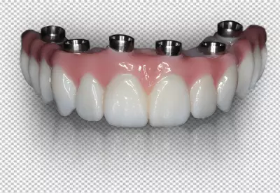 a dental prosthesis, which is a false tooth that is used to replace one or more missing teeth