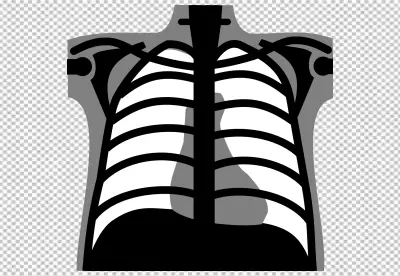 X-ray Image of a Human Chest