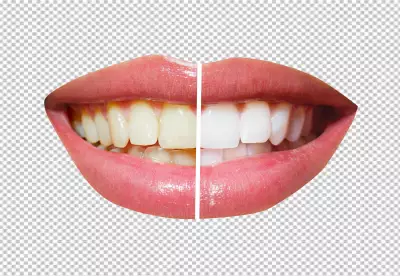 a woman's smile with yellow teeth on one side and white teeth on the other side