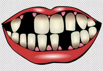 a cartoon of a mouth with crooked teeth
