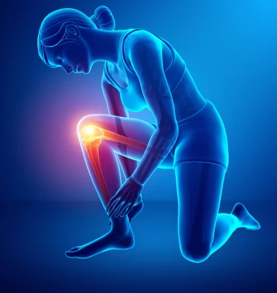Female Anatomical Illustration Highlighting Knee Pain and Leg Injury in Glowing 3D Render image